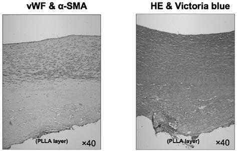 (a) 図 1 a PGA/PLLA-collagen patch b 6 (b) 図 2 PGA/PLLA-collagen graft PGA PLLA 2 PLLA PGA 2 4 mm