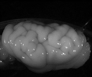 図 1 大脳の表面に見られる正常な脳回 ( シワ ) とその異常左 ) 正常なフェレットの大脳に見られる脳回 右 ) タナトフォリック骨異形成症のフェレットの大脳に見られる多小脳回