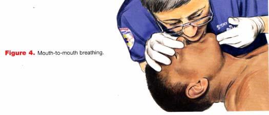 秒以内で確認する 呼吸をしていなければ人工呼吸 1: 頭部後屈顎先挙上法で気道確保を続ける 2: 人差し指と親指で鼻をつまむ ( 額に置いた手を用いて ) 3: 普通に息を吸い (