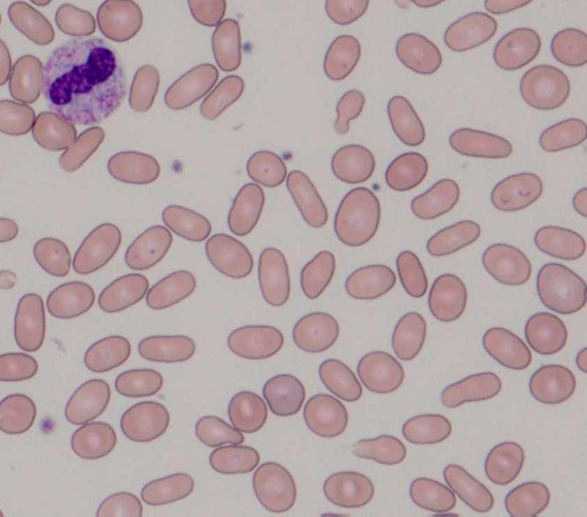 フォトサーベイ結果 ( 設問 15) 楕円赤血球正解率 97.