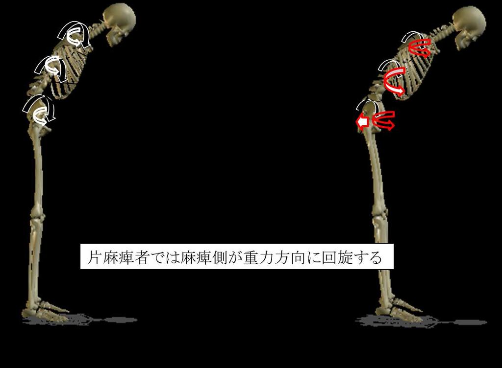 5-5. 立位のまとめ片麻痺者の静止姿勢では, 中部体幹の前傾角度が大きく, 上部体幹が中部体幹に対し後傾していた. また, 前傾動作では, 骨盤 中部体幹 上部体幹の前傾角度が小さく, 非麻痺側の骨盤を後方に引いていた. 静止立位の結果から, 片麻痺者では骨盤と中部体幹の間の抗重力伸展保持能力が不足していると推察できる.