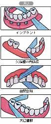 DENTAL FLOSS 伸縮性が高く 狭い歯間空隙にも容易にアクセス