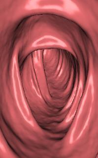下部消化管 (S 状結腸内視鏡検査 ) 肛門から内視鏡を挿入し 大腸がんの好発部位とされる直腸 S 状結腸を直接観察する検査です