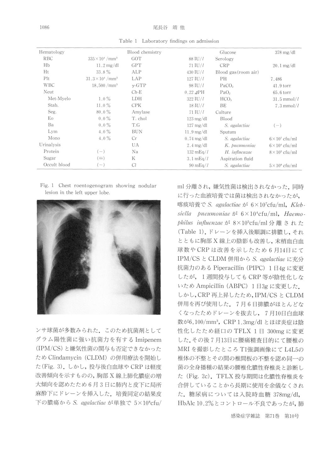 尾長谷 靖 他 1086 Table Fig. 1 lesion Chest roentogenogram in the left upper showing 1 Laboratory nodular lobe. findings on admission ml分 離 さ れ,嫌 気 性 菌 は 検 出 さ れ な か っ た.