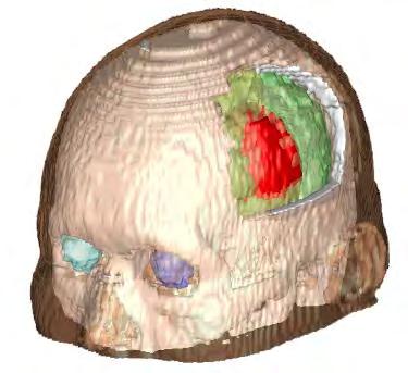 MRI Data 医療画像 患者 3
