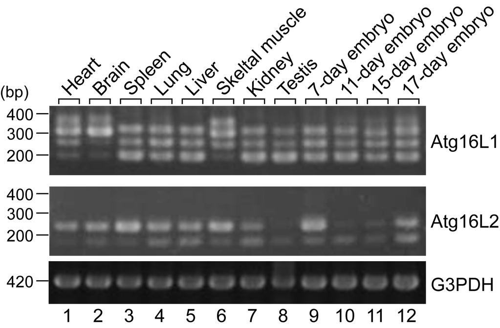 図 3 Atg16L1, L2 の発現プロファイル (PCR).