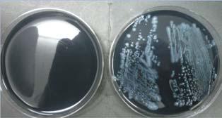 (Buffered Charcoal Yeast Extract) 寒天培地に抗菌剤を添加した培地が WYOα (WadowskyYeeOkuda αketoglutaric acid) 寒天培地 ph6.
