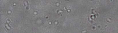dysgalactiae/equisimilis ラテックス C 群 Streptococcus dysgalactiae で報告