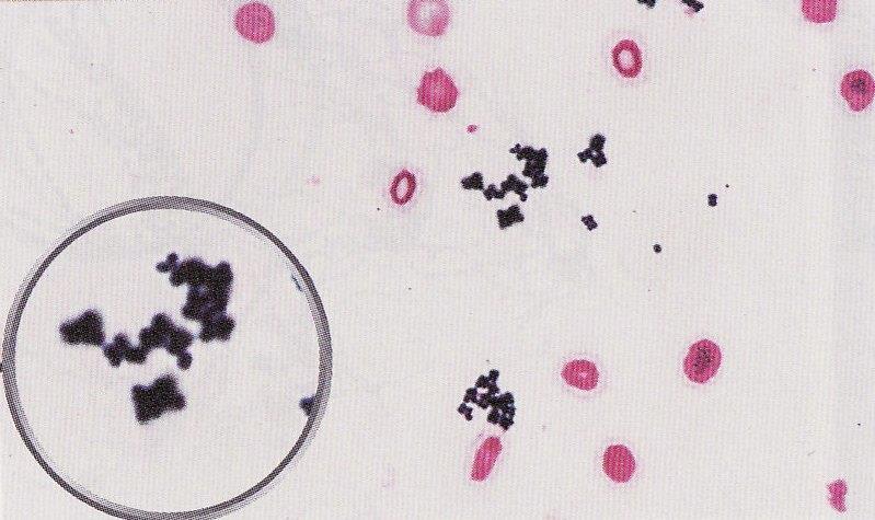 グラム陽性球菌 Staphylococcus aureus