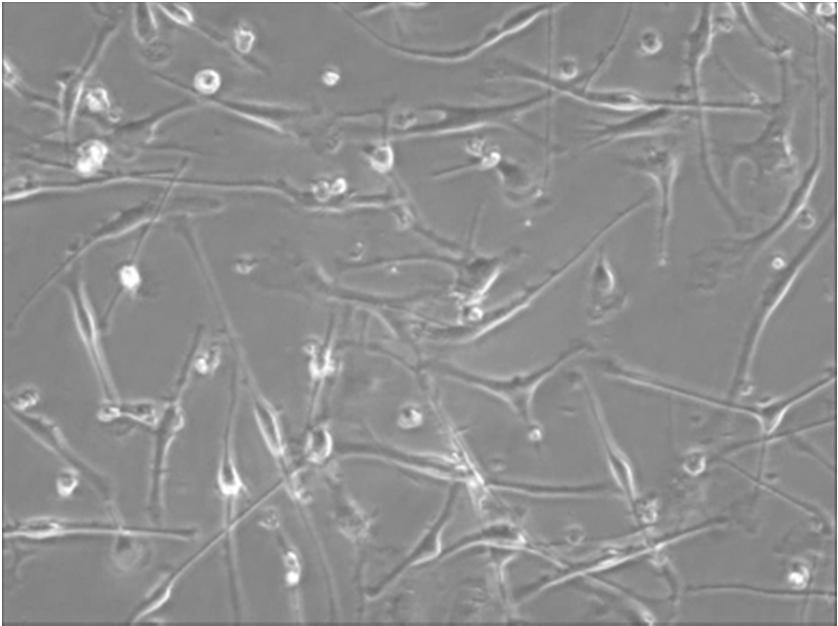 成熟樹状細胞 mdc): 単球からGM-CSF IL-4で培養 (Day0)
