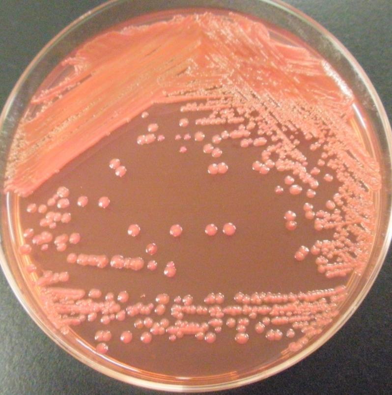 (Cronobacter) 属に再分類された 本菌による髄膜炎を報告した坂崎利一博士に因んで E.