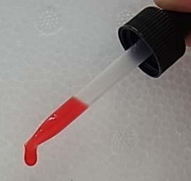 検体の採取と管理 血球浮遊液の性状と血球濃度 血清 : 血球の比率 反応増強液の種類と使用法