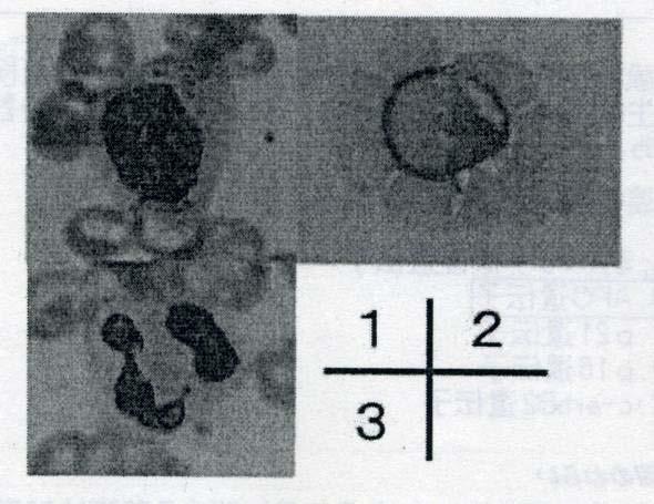 04-14: 顆粒球の分化成熟の順番で正しいのはどれか A.