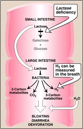 図 7.11 小腸 大腸 乳糖不耐症 ラクターゼ欠損 乳糖 ガラクトースグルコース 大腸で乳糖は細菌のえさに 乳糖
