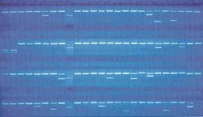 96 PCR PCR DNA Taq Unitray EB UniMatch DNA 2 SSP