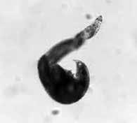 (1)Anguina 属センチュウ : 植物寄生性線虫の発見この属の線虫は seed gall nematode という英名が示すように 最初 小麦の穀粒から発見された 発見したのはイギリスのカトリック教の司祭 ジョン ニーダムで 1743 年のことである これが 植物寄生性線虫の最初の発見であった 彼は黒くなった小麦の穀粒をそっと開いて見たら 中から繊維状のものが出てきたので