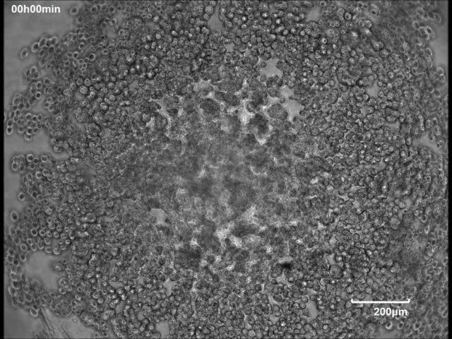 ヒト ips 細胞凝集塊 ( 胚様体 ) 形成過程のタイムラプス 撮影機器 :BioStudio ( コアフロント株式会社 ) 培養条件 培養器使用細胞 : hips 細胞 (201B7: Takahashi K et al. Cell, 2007 Nov 30;131(5):861-72, ips Academia Japan, Inc.