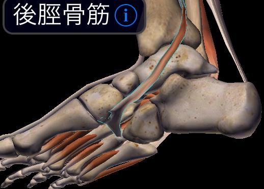 外脛骨障害 ( 骨 骨髄 + 腱 ) Type1 外脛骨が小さく舟状骨から分離して後脛骨筋腱の中に含まれる Type2 大きくて舟状骨粗面と繊維製または繊維軟骨性に結合して付着部の一部となる Type3 舟状骨と癒合して外脛骨は突起状になる Veitch