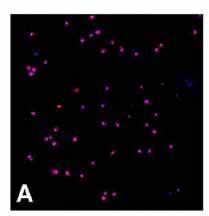 ALDEFLUOR Neural stem cells (NSC) ALDH br