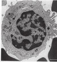 細胞表面に微絨毛がみられる 3 血小板血小板の凝集は内皮障害の所見 腎炎でみえる 1. 無核の円盤細胞 細胞辺縁に小管や細線維が輪状に走行. 2.