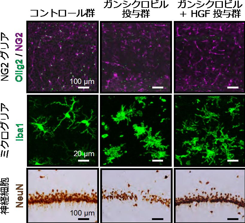 さらに NG2 グリアが除去された海馬組織に HGF タンパク質を補うことにより 活性化型ミクログリアによる炎症反応は鎮静化され 海馬での神経細胞傷害が軽減されることも分かりました ( 図 2) 以上の結果から NG2 グリアは HGF を供給することによって神経炎症を抑制し 海馬神経細胞を保護していることが示唆されました 図 2 肝細胞増殖因子 (HGF) による神経炎症の抑制と神経細胞の保護