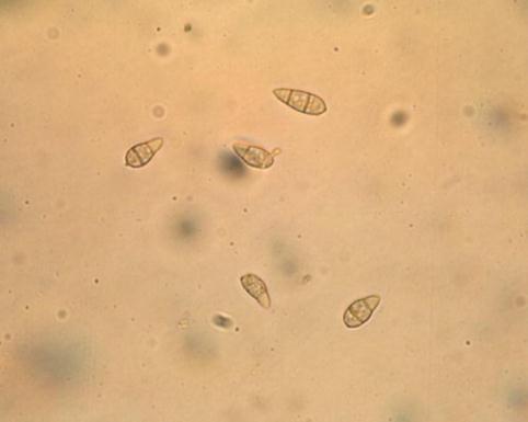 1, 2) 写真 1 いもち病菌の胞子 ( 1) 写真 2 いもち病菌の胞子 (
