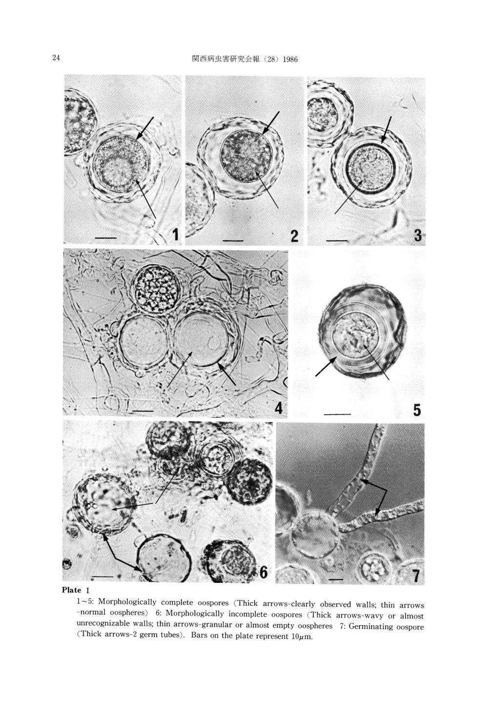 24 関 西 病 虫害 研 究 会報(28)1986 Plate I 1 `5: Morphologically -normal complete oospheres)6: oospores(thick y unrecognizable (Thick arrows-2 arrows -clearly observed walls; thin arrows