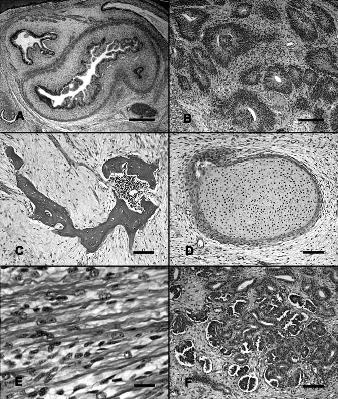 マウス ES 細胞由来の奇形種 gut neural epithelium bone cartilage