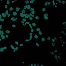 これらのレンチウイルスを感染させた場合 混入した線維芽細胞 ( 活発に増殖する細胞 ) が特異的に GFP 陽性になるが ニューロン ( 非分裂細胞 ) はほとんど陰性であったことからも ( 図 2) この可能性を支持する 雑誌論文 ( 計 8 件 ) 1 Robel S, Mori T, 以下 7 名, Conditional deletion of beta1-integrin in
