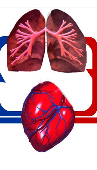 熱希釈測定範囲の違い Swan-Ganz( 肺動脈 Cath) 測定範囲 主に右心系のパラメータ -CO PaP PaWP 肺動脈抵抗 SvO2 など PiCCO system