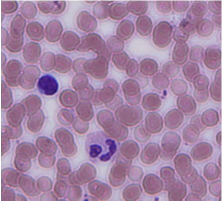 好酸球 白血球 単球 樹状細胞 リンパ球 T 細胞
