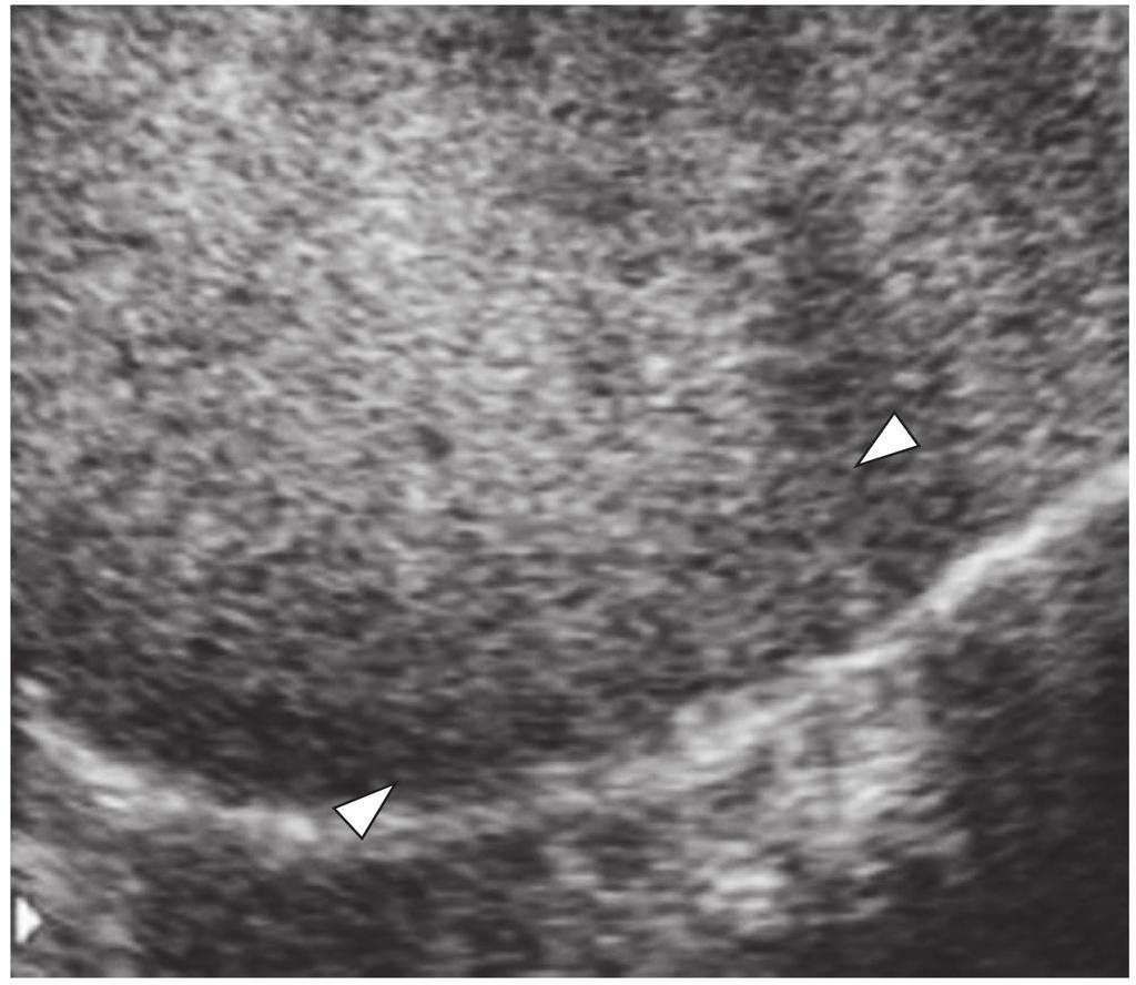 6 Contrast-enhanced ultrasonography examination Vascular