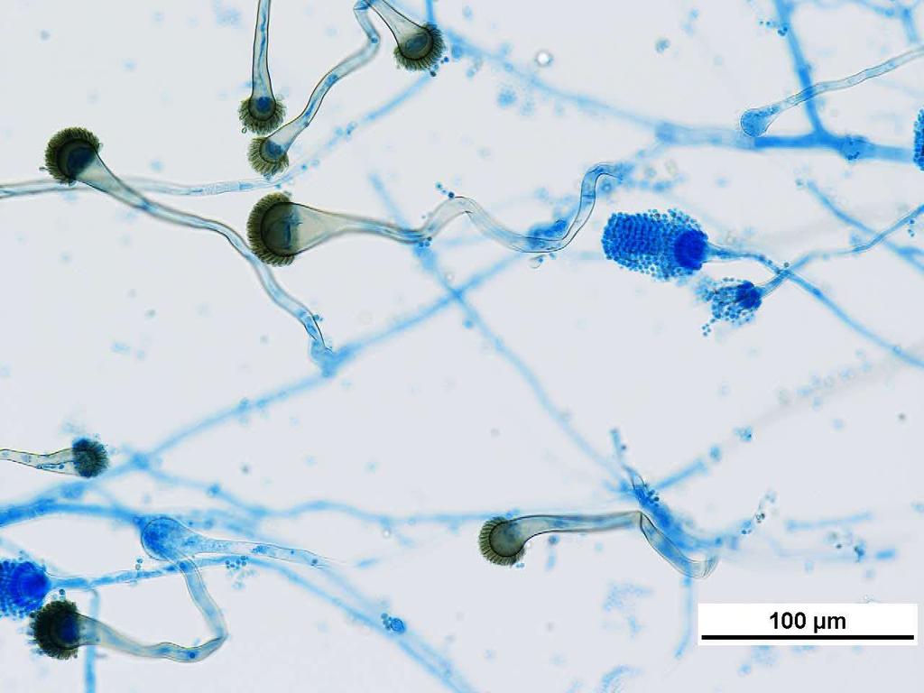 アスペルギルス 分生子頭 分生子柄 菌糸