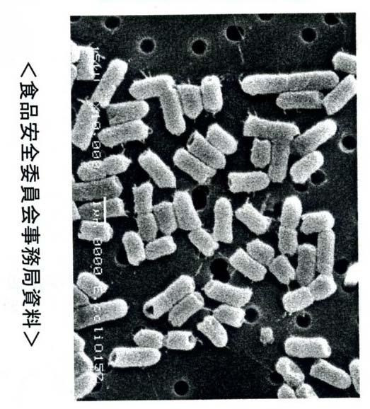 腸管出血性大腸菌 O157