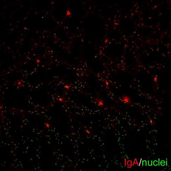 IgA 産生細胞数 IgA mrna 対照区 βカロテン区 (