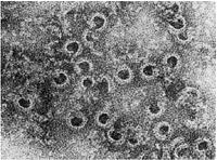 + MBL( レクチン) レクチン経路 細菌 & 自然抗体 ( IgM) 複合体 C1q