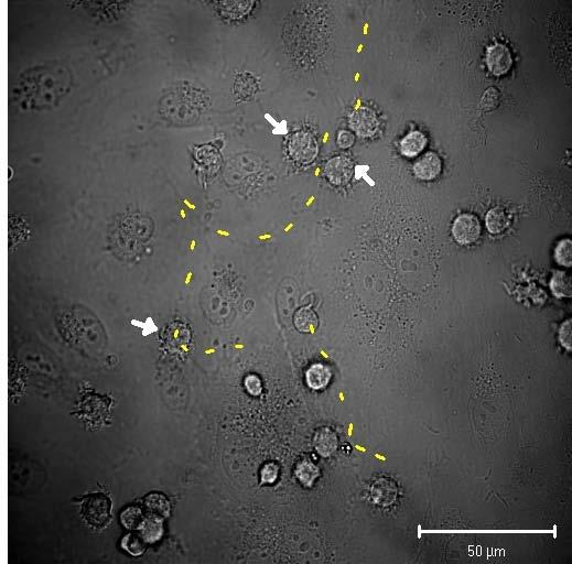 Plexin-A1 欠損樹状細胞はリンパ管通過できない 樹状細胞をのせる リンパ管内皮細胞 3 min