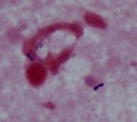 レンサ様 グラム陽性球菌 Streptococcus sp.