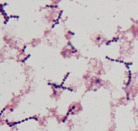 心内膜炎?) Streptococcus bovis ( 大腸癌?) Enterococcus sp./ 腸球菌 ( 腸管病変?