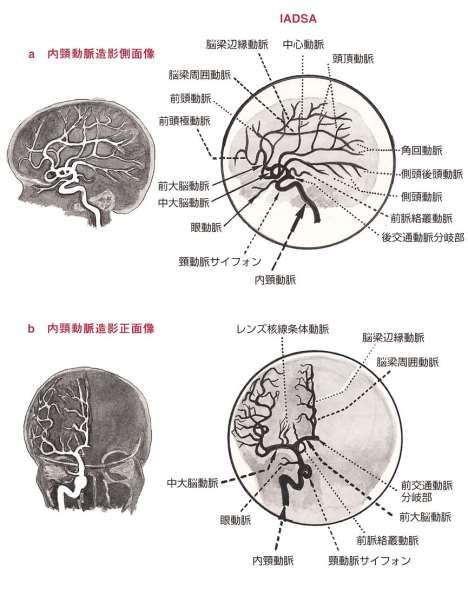 脳血管の走行 ( 動脈 )