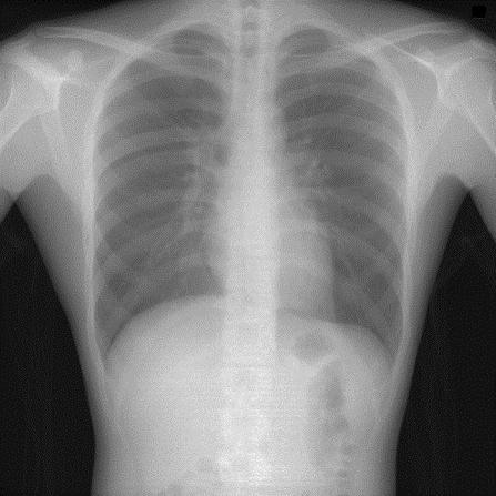 FPDによるX線動画像の取得 X-ray