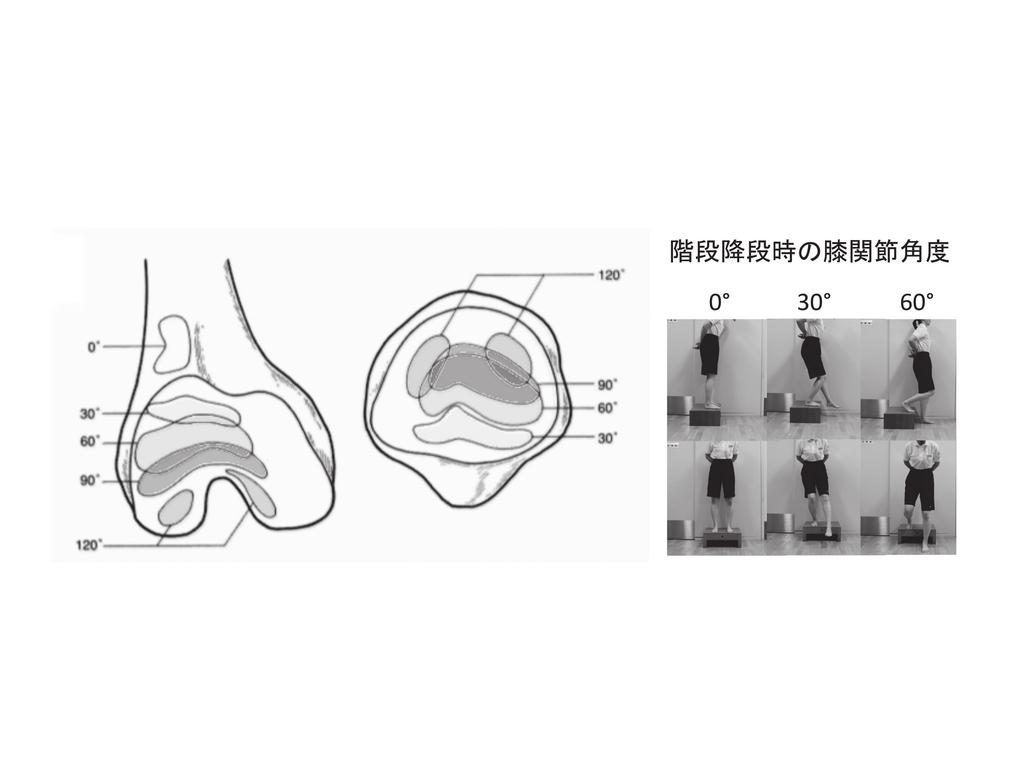 階段降段時の膝関節角度 図 1 膝屈伸運動による膝蓋大腿関節接触面の変化 2 P.