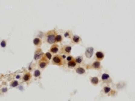 形態学的に異型を検出できない細胞の中から前癌状態にある細胞を拾い出せるかもしれない 図 3a,b