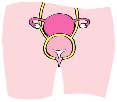 筋層非浸潤性がん ) 浸潤性がん 転移がんの 3 つのタイプに分けられます 膀胱は骨盤の中にあり 腎臓でつくられ腎盂