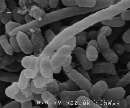 歯周病菌による実験的細菌バイオフィルム 7 日間培養すると個々の菌体は判別できない (SEM X20,000) 2)