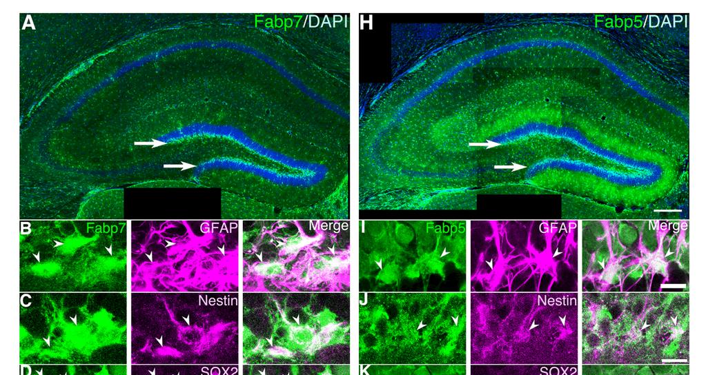 図 2: 神経幹細胞の分化に伴った Fabp7 および Fabp5 の発現の変化海馬歯状回顆粒細胞層下帯における Fabp7 と Fabp5 の発現 図 2 の左側 (A-G) の緑のシグナルが Fabp7 の 右側 (H-N) の緑のシグナルが Fabp5 の局在を示している