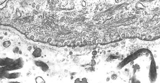 ラミナデンサがほぼ全域にわたって観察された BIO を添加により 基底膜のラミナデンサは電子密度が低くなり 発達したコラーゲン線維の進入により連続的でない部分も見られた 基底膜側の表皮細胞の細胞膜周辺にはいくつもの小さな小胞が見られ 小胞内には顆粒の存在も確認できた ( 図 8) 6 研究成果のまとめ以上の結果から