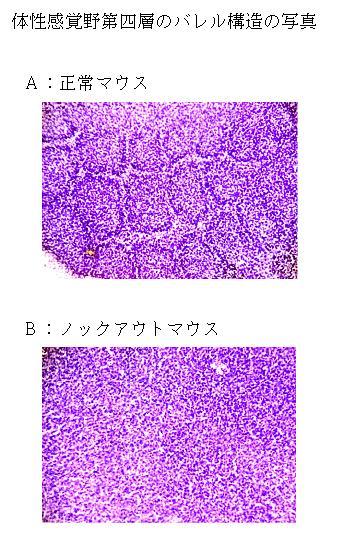 図 3 バレル構造の写真 A: 生後 7 日の正常マウスの大脳皮質体性感覚野第四層 バレル構造が発達している B: