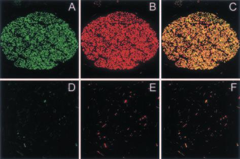 Fig.4 パーキンソン病の心外膜神経束の二重免疫染色.