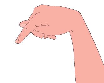 図 3A テタニーに特有の指位手関節の屈曲, 母指の回内,MP(metacarpo phalangeal) 関節の屈曲およびPIP (proximal interphalangeal) DIP(distal interphalangeal) 関節の伸展を呈することである. しばしば第 2 3 指と第 4 5 指が二群に分かれるために, 助産師手位 ( 指位 ) と呼ばれる形状を示す.